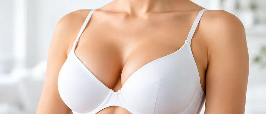 Femme portant un soutien-gorge blanc illustrant la chirurgie et la reconstruction mammaire